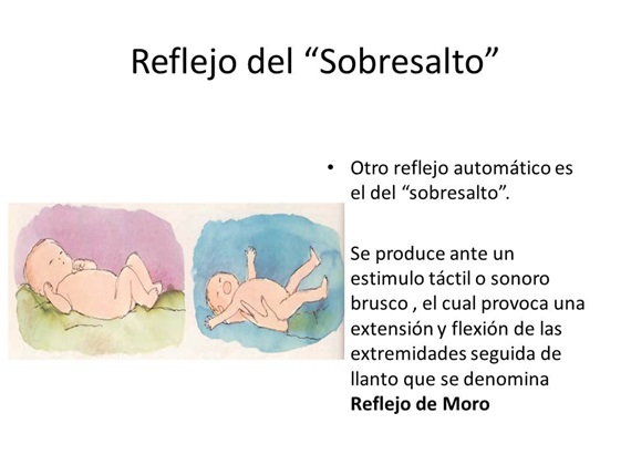 Reflejo del sobresalto